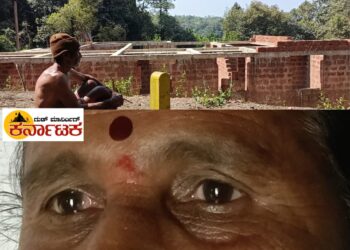 Bekkodi| ನಾವು ಸತ್ತಂತೆ ಆಗಿದೆ.. ಬದುಕಿಸಿ ಉಳಿಸಿ ಸ್ವಾಮಿ.. ಕೈಮುಗಿದು ಬೇಡಿದ ಬಡ ರೈತ ಕುಟುಂಬ